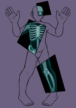 X-RAY | HUMAN VERS |
